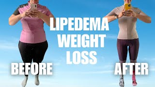 How to LOSE WEIGHT With LIPEDEMA