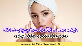 කුරුළෑ වලින් තොර දිදුළන සමක රහස😇✨ | How to Prevent & Treat Pimples & Acne