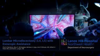 Lumbar Microdiscectomy (L4, L5) with Exoscopic Assistance