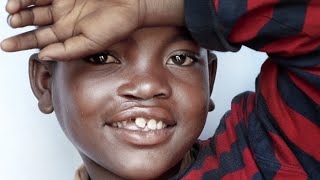 Operation Smile and how you can help.