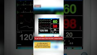 ICU monitor | icu monitor readings explained | icu monitor readings explained in hindi #medicoinfo