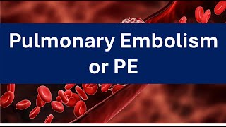 Pulmonary Embolism Short March 2024