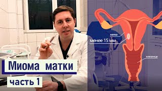 МИОМА матки |  | ПРИЧИНЫ | СИМПТОМЫ | одно из САМЫХ ЧАСТЫХ заболеваний у женщин