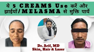 5 CREAMS FOR MELASMA TREATMENT @DrArifMDDermatologist  #melasmatreatment #melasma