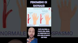 Dita Bianche? Fenomeno di Raynaud