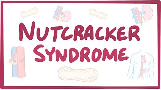 Nutcracker syndrome - causes, symptoms, diagnosis, treatment, pathology