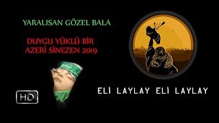 YARALISAN GÖZEL BALAM DUYGUSAL AZERİ SİNEZEN