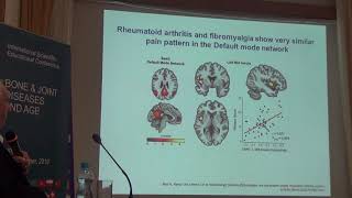 The role of cytokines in pain processing: pathways of central pain and fatigue sensation. L. Hodinka