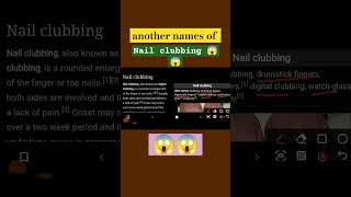 names of nail clubbing #shortsvideo #shortsviralvideo #shorts