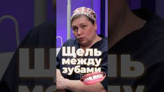 Щель между зубов| Причины диастемы #зубы #щель #десна #хирург #стоматология