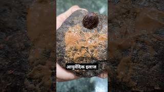 सर्दी ख़ासी के घरेलु आयुर्वेदिक इलाज  बच्चों की सर्दी तुरंत ठीक करे #sardi #remedy