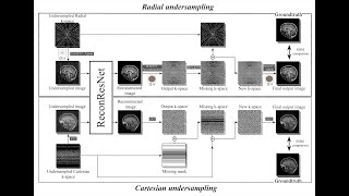 Regularised residual learning for MR image reconstruction of Undersampled Cartesian and Radial data