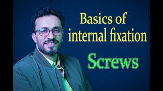 02 Basics of internal fixation: Screws