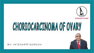 CHORIOCARCINOMA OF OVARY  | Female Genital Tract