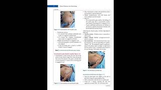 Breast Examination|| Sign of pregnancy || pregnancy Test #upgnm