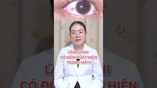 Đốm đỏ trong mắt - Phải làm gì? Có nguy hiểm không? #tintuc #suckhoe #lamdep