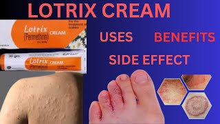 Lotrix cream ! LOTRIX cream for scabies ! HOW to use lotrix cream ! premethrin cream