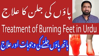 Burning Feet Causes and Treatment | Burning Sensation in Feet | Foot Burning | Burning Feet Cure