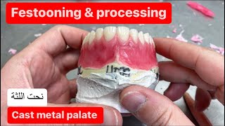 FESTOONING AND PROCESSING AN UPPER DENTURE (CAST METAL PALATE) #waxbae