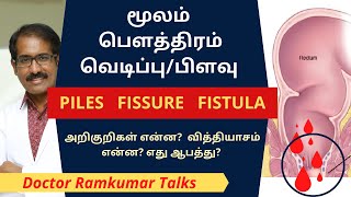 Fissure vs Piles vs Fistulas. பைல்ஸ், பௌத்திரம், ஆசன வாய் பிளவு. அறிகுறிகள் என்ன? வித்தியாசம் என்ன?