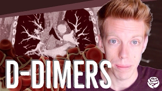 D-Dimers (Medical Rant)