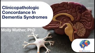 Clinicopathologic Concordance In Dementia Syndromes