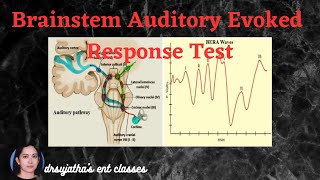 210.Brainstem Evoked Response Audiometry BERA Part 2/2 #bera #oae #screening