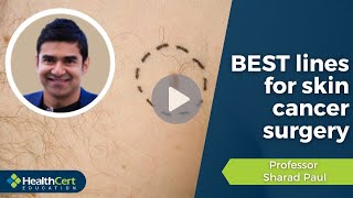 BEST lines for skin cancer surgery • Surgery Masterclass 2021 • Prof Sharad Paul