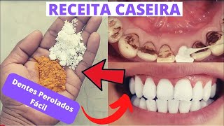 Como Clarear Seus Dentes Sem Gastar Dinheiro - 2 Receitas  Caseira  Muito Fácil de Fazer em 1 Minuto