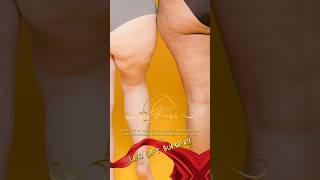 GCC Clinic 0850 202 0207 İstanbul Turkey Liposuction Leg Lift Surgery