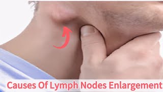 Causes of Lymph Nodes Enlargement|Swollen Lymph Nodes