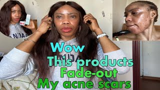 Face cream’s that clear acne scars & update of my body creams#acnescars #brightening#skin#Ruchi Ata