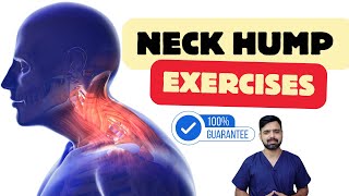 Neck Hump Exercises | Neck Fat Loss Exercises | Dr Sunil Tank