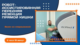 Робот-ассистированная передняя резекция прямой кишки I Савенков Дмитрий I Днепр