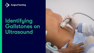 Learn How to Spot Gallstones on Ultrasound