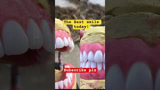 The of best of the best #dentures #shortvideo #fypシviral #denturecare #dentalhealth