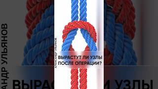 Могут ли геморроидальные узлы появиться ПОСЛЕ операции? #проктолог#геморройлечение #геморрой#узлы