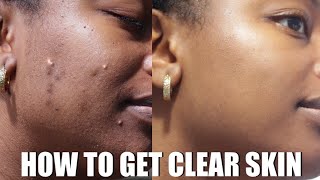 SKIN CARE ROUTINE | HOW TO GET CLEAR SKIN AND FADE DARK MARKS