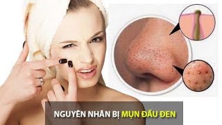 Mẹo loại bỏ đầu đen vùng mũi phần 2#issence#lớphọcspa#huongtran