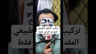 تركيب"الشعر"الطبيعي"للرجال"في"صنعاء اليمن"#مركز_المليونير_للحلاقة_والعناية_بالرجل773999921الوتساب