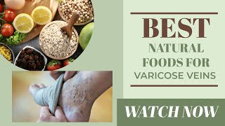 Remove Varicose Veins With Lemon...Do These Simple Life Hacks!