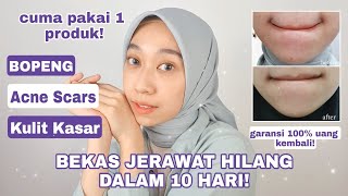 CARA MENGHILANGKAN BEKAS JERAWAT DALAM 10 HARI! TERBUKTI EFEKTIF! ELIXSKIN Aizen Dermalogy