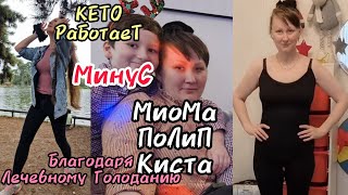 Как решились Мои ❗️ГИНЕКОЛОГИЧЕСКИЕ❗️ проблемы благодаря Лечебному Голоданию/Кето Работает!