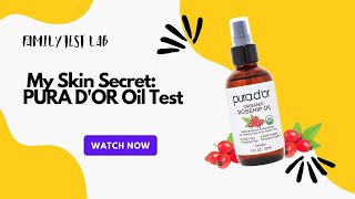 Glowing Skin Secret? PURA D'OR Rosehip Oil PUT TO THE TEST!