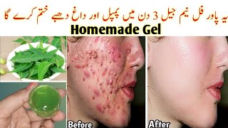 I applied👆🏻this DIY Neem Gel on Acne, Pimples, Pigmentation,Bumps - Got Clear Glowing Skin In 3 Days