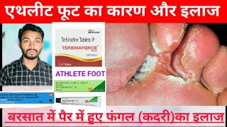 एथलीट फूट इन्फेक्शन होने का कारण और इलाज।ATHLETE FOOT INFECTION TREATMENT। बरसात में फंगल Dawai Wala