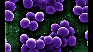 Staphylococcus Aureus