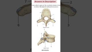 identify the parts of vertebrae #humananatomy