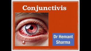 EOV & TCM concept for conjunctivitis, Quiz given below to test your knowledge as per this video