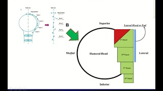 All About Subscapularis Tendon Tears